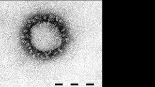 23+ Sars Virus Microscope Image Gif